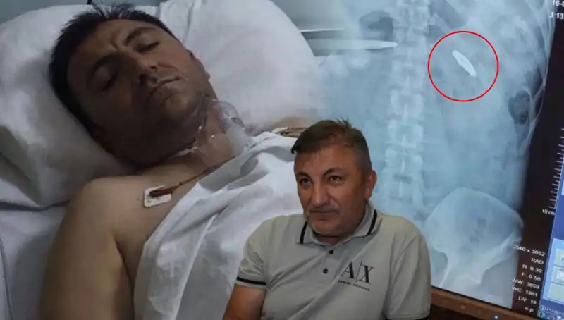 15 Temmuz’un Unutulmaz Acısı: Vücudunda 9 Yıl Sonrasında Kurşunla Yaşayanlar