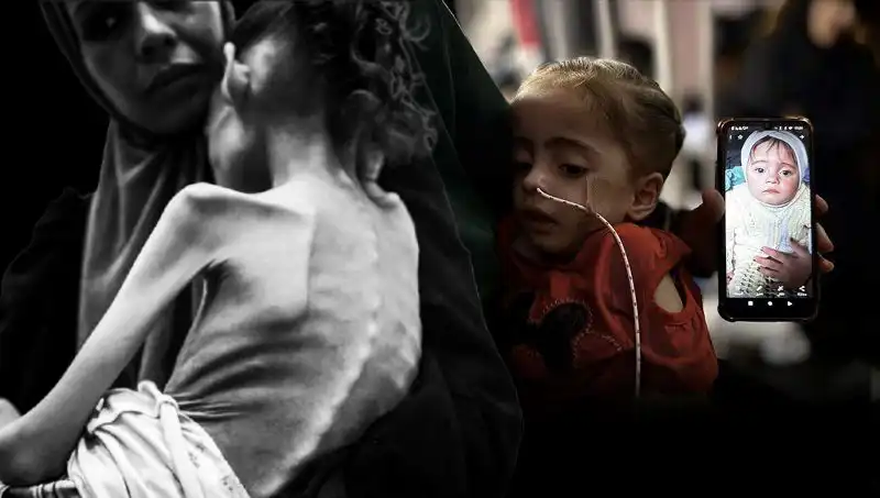 25 Kilodan 10 Kiloya Düşen Meryem'in Açlıkla Mücadelesi: Bir Umut Hikayesi