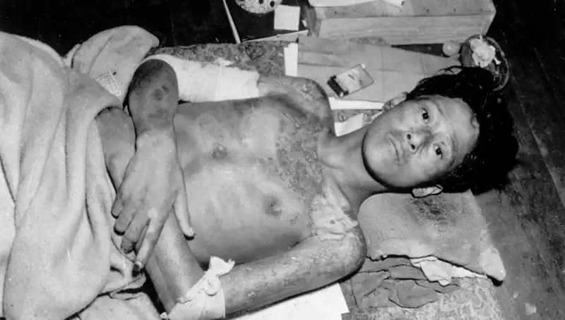 80 Yıl Sonra Nagasaki'den Çarpıcı Çağrı: Nükleer Felaket Alarmı!